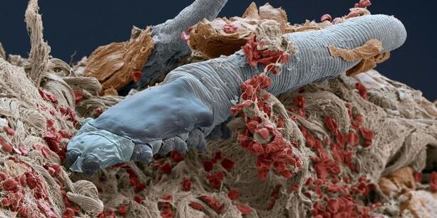 acaro demodex