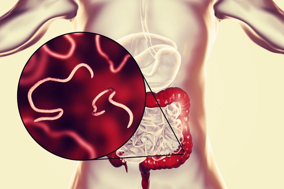 vermi nell'intestino umano